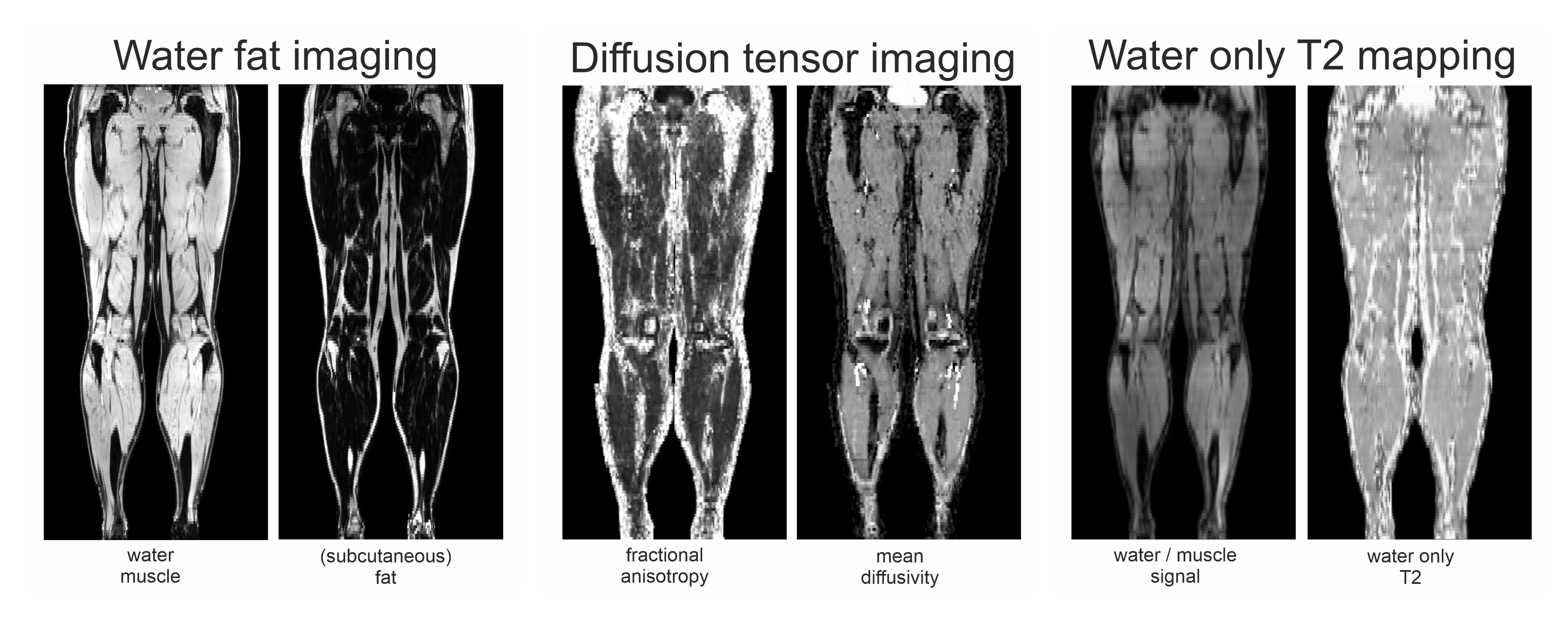 Whole leg quantitative MRI of skeletal muscle